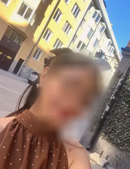Naja, 26